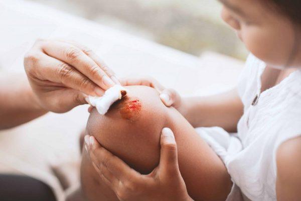 5 Mitos Ibu Bapa TIDAK Boleh Percaya Ketika Merawat Luka Anak!