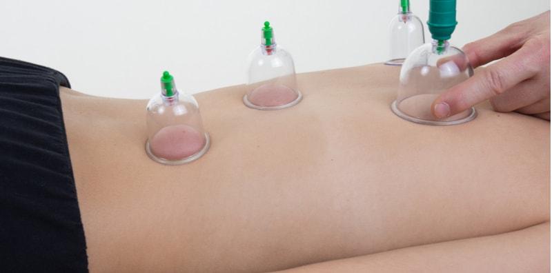 bekam-tiada-bukti-kukuh-menyokong-keberkesanan-merawat-penyakit