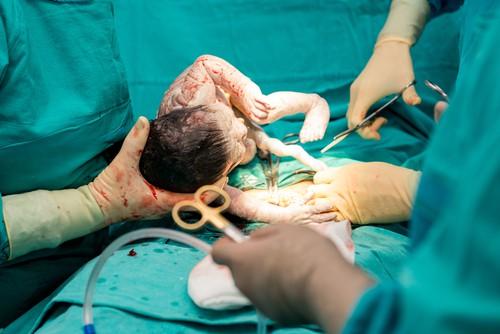 Bulan Kesedaran Caesarean Sedunia 2019: Perancangan Kelahiran Tanpa Menolak Prosedur Ini
