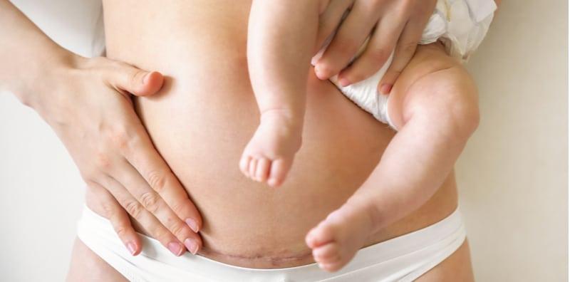 Belum Cukup Tempoh, Tapi Ibu Bersalin Czer Hamil Kembali, Ini 4 Risiko Boleh Berlaku Pada Anda