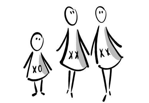 sindrom-turner-keadaan-kromosom-mempengaruhi-perkembangan-wanita