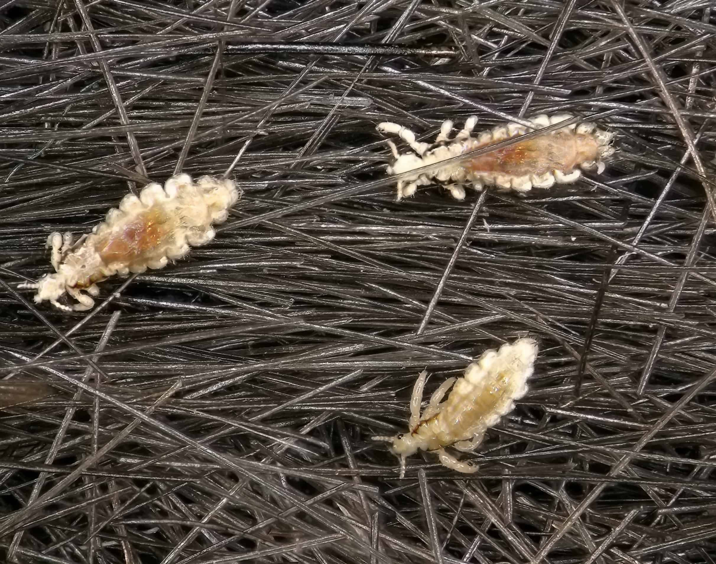 Kutu Rambut Kanak-kanak: Adakah Satu Masalah Besar?