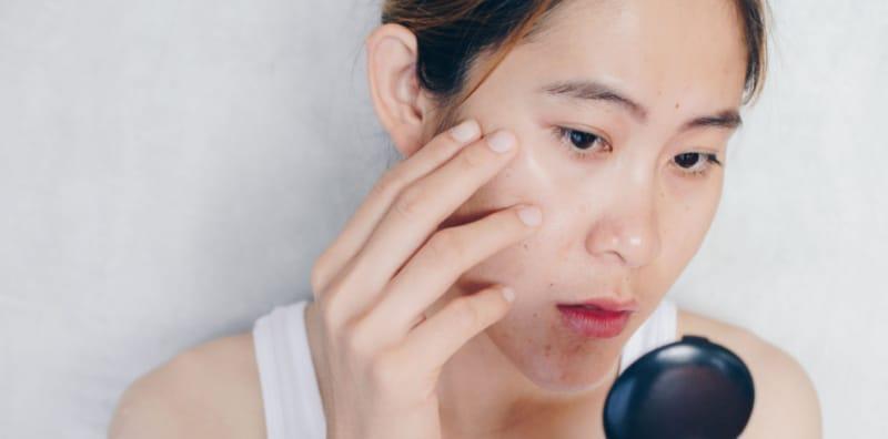 Kulit Kerap Berminyak? Ini Tip Memilih Pencuci Muka & Cara Penjagaan Wajah Yang Betul