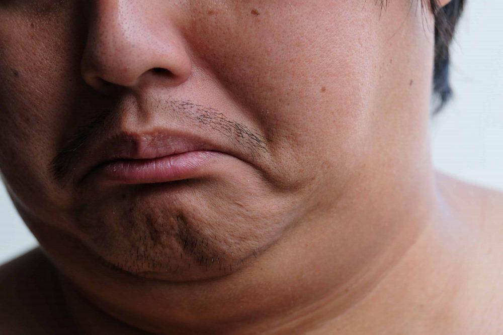 tidak-boleh-cakap-gemuk-pada-orang-lain