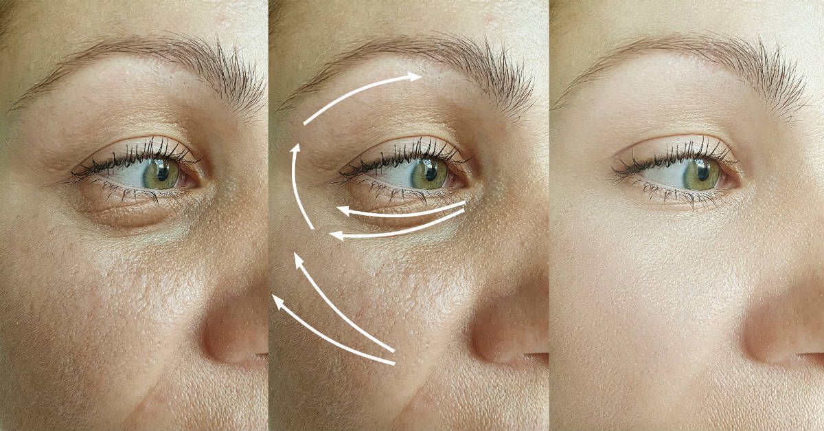 tengok-wayang-punca-muka-berkedut