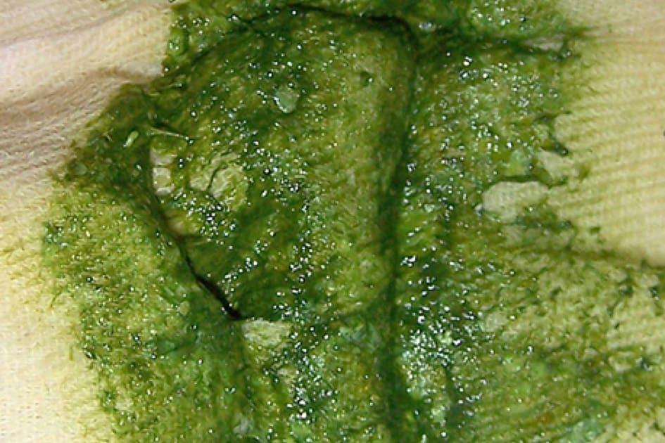 Berwarna hijau terang