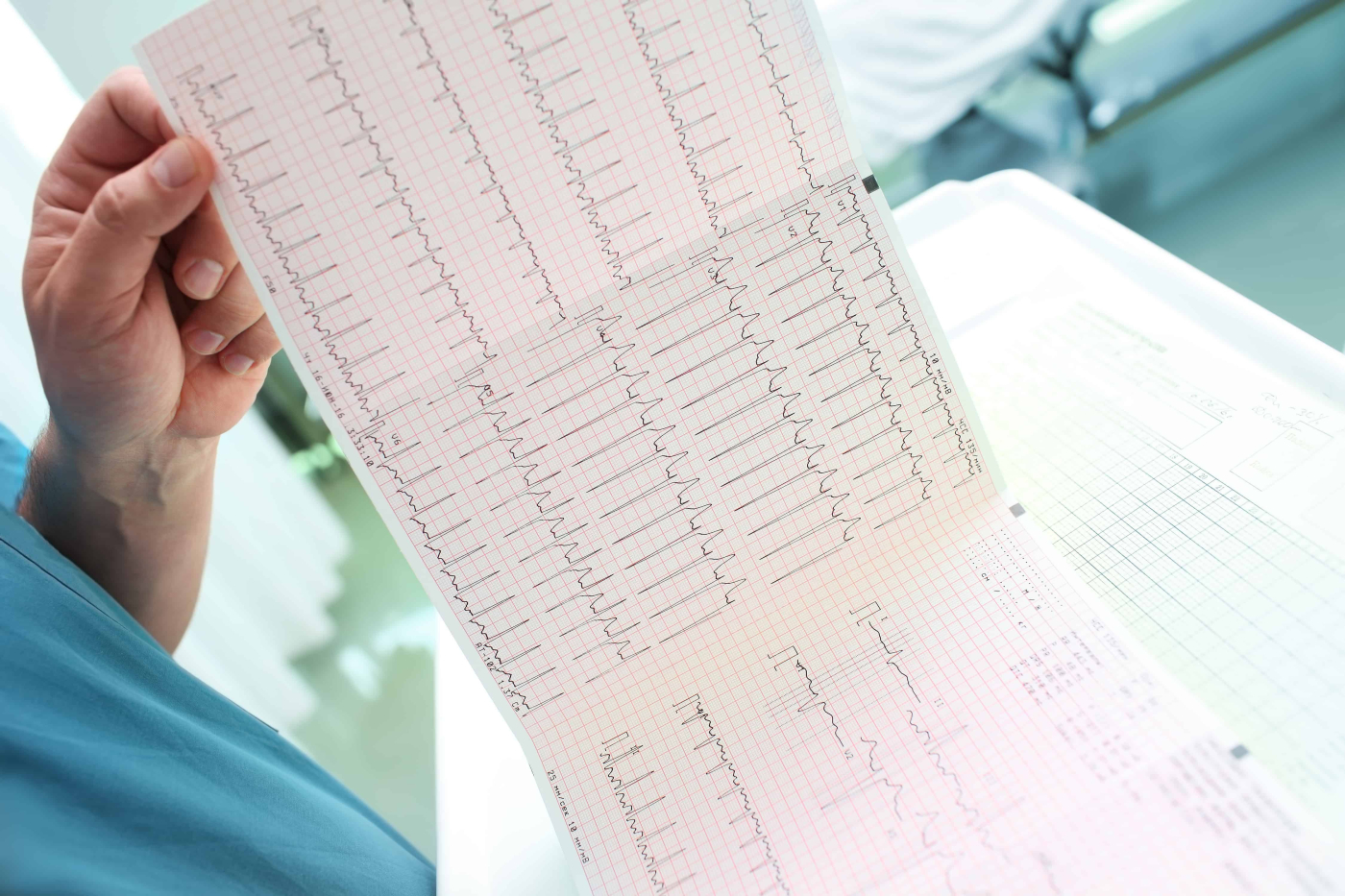 Cardiac Arrhythmia