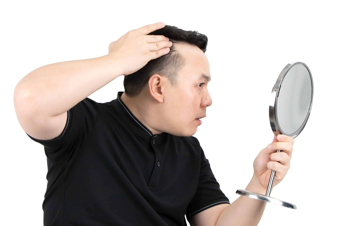 Kebotakan, Masalah Rambut Paling Kerap Dialami