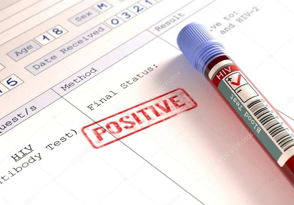 Positif HIV Bukan Maksud Putus Harapan, Ini Rawatan HIV Yang Perlu Dibuat