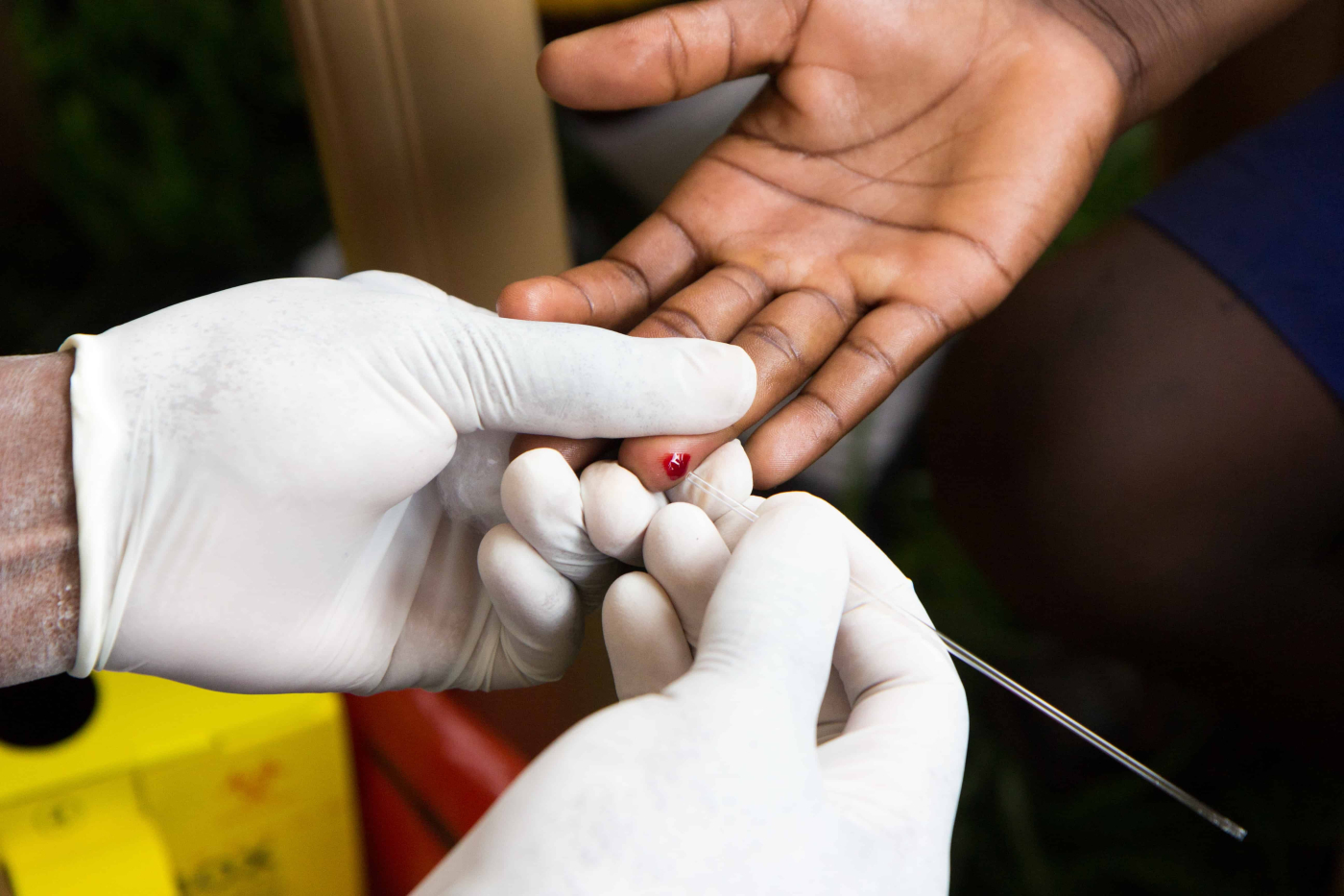 Adakah HIV Masih Lagi Satu Epidemik Global?