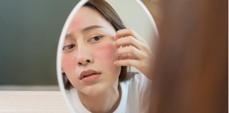 ketahui-punca-kulit-kering