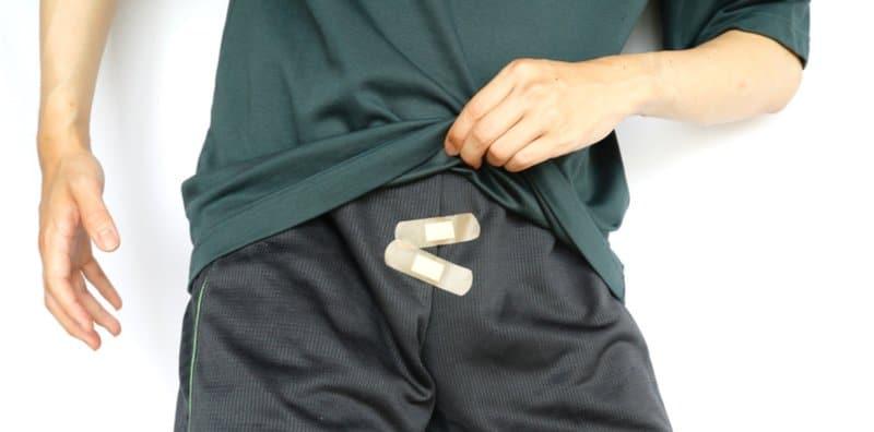 ulser-kemaluan-sifilis