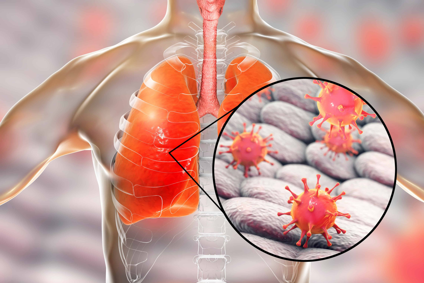 3 Perbezaan Novel Coronavirus Dan SARS Coronavirus Yang Anda Perlu Tahu!