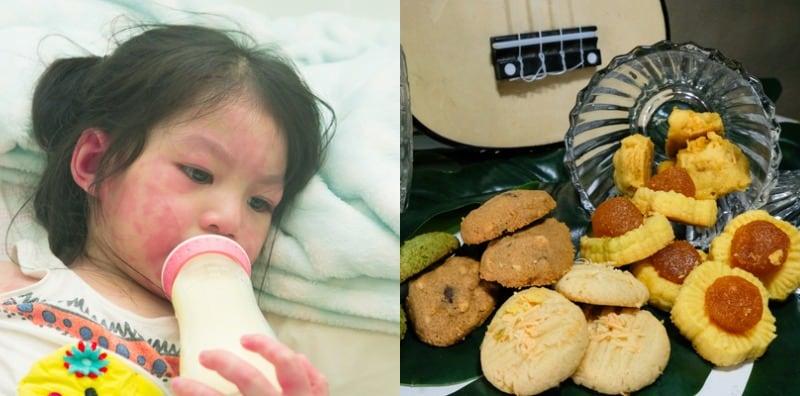 Jangan Bagi Sebarangan Kuih Raya Pada Anak! Ini 12 Tanda Si Manja Alami Alahan Telur