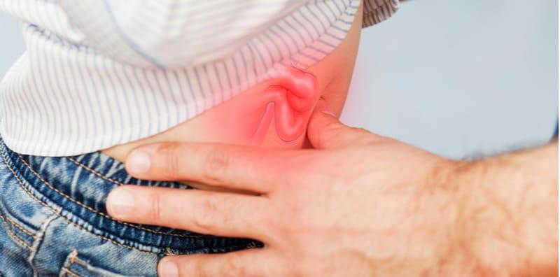 apa-itu-hernia-angin-pasang