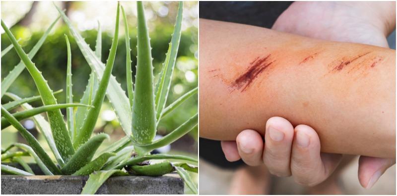 Daun Lidah Buaya Bukan Setakat Bagus Untuk Rambut & Kulit, Tapi Boleh Juga Rawat Luka!