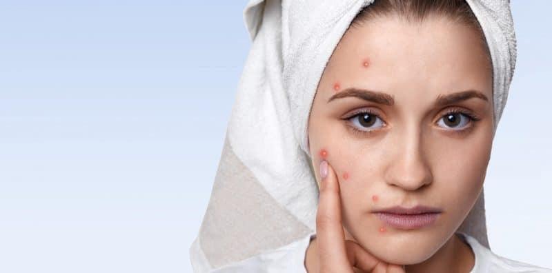 Nak Cantik Sampai Tak Ambil Tahu Kesan Pada Wajah, Ini Bahaya Jika Pakai Kosmetik Ada Merkuri!