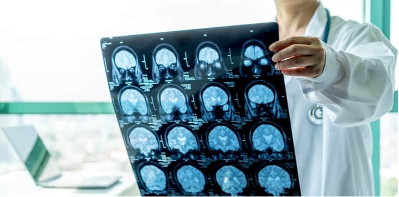 Meningitis Penyakit Berjangkit! Ketahui Faktor Risiko & Tandanya