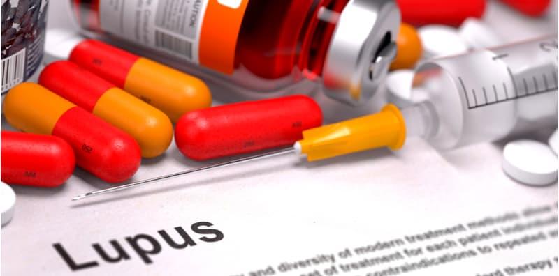 Jangan Ambil Mudah Penyakit Lupus, Perlu Dirawat Jika Tidak Boleh Bawa Maut!