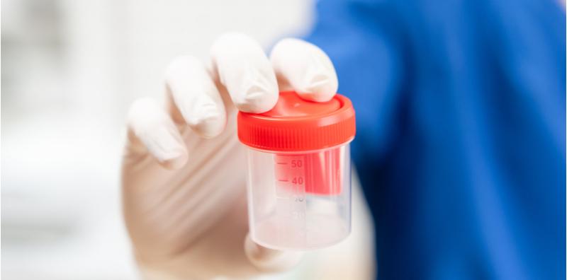 7 Sebab Orang Lelaki Kena Buat Ujian Kiraan Air Mani, Boleh Tahu Subur Ke Tidak!