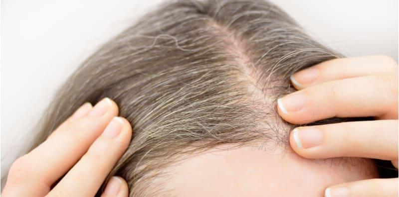 Muda Lagi Tapi Rambut Dah Tumbuh Uban? Ini Sebab Stress Dan Banyak Berfikir Ke?