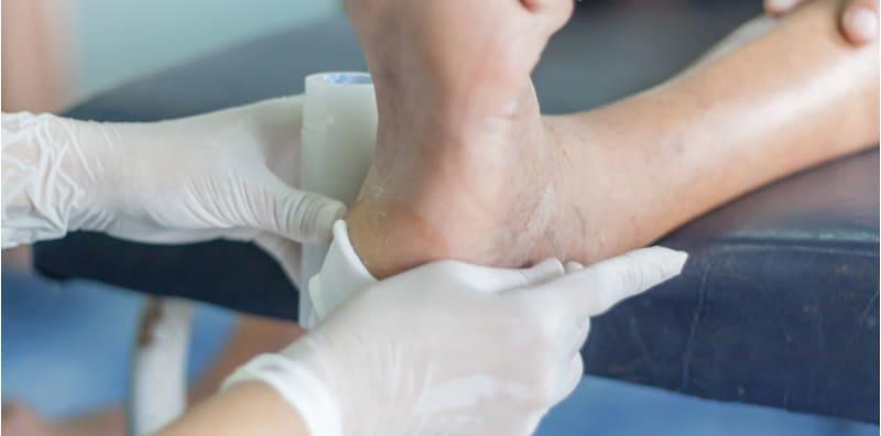 penjagaan-pesakit-diabetes-ulser-kaki