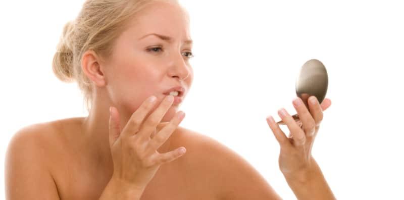 kulit-kering-sekitar-mulut