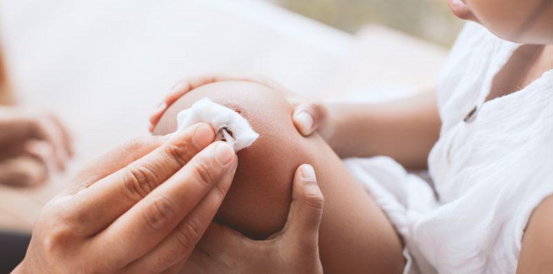 anak-penyakit-hemofilia