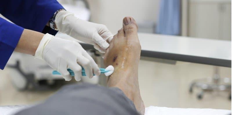 luka-kencing-manis-diabetes