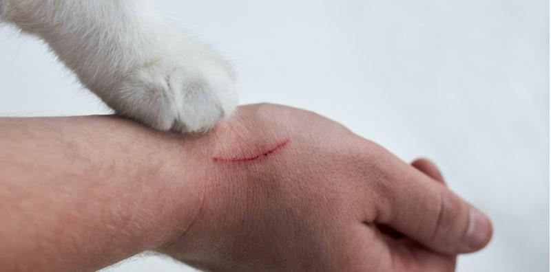 Hati-hati Pencinta Kucing! Anda Mungkin Dijangkiti Penyakit Kulat Sporo Ini