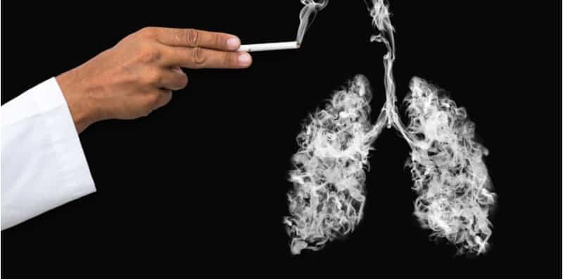 Diagnosis Kanser Paru-Paru, Individu Berisiko WAJIB Buat Pemeriksaan Kesihatan Setahun Sekali