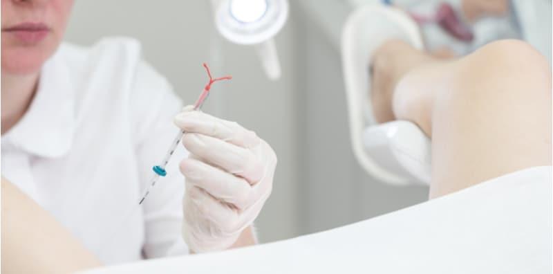 pemakaian-iud-cegah-hamil