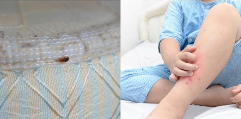 kesan-gigitan-pepijat