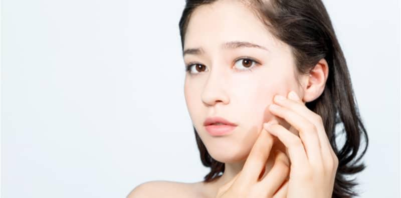 masalah-kulit-tukar-produk