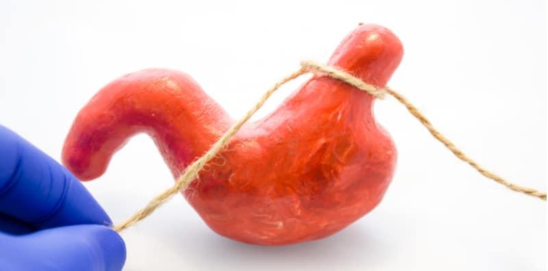 Bukan Rawat Obesiti Sahaja, Pembedahan Ini Juga Beri Manfaat Buat Diabetes!