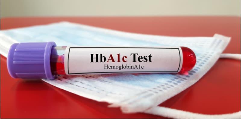 Ini Cara Mudah Mengesan Diabetes Jenis 2, Ada Beberapa Ujian Kena Lalui