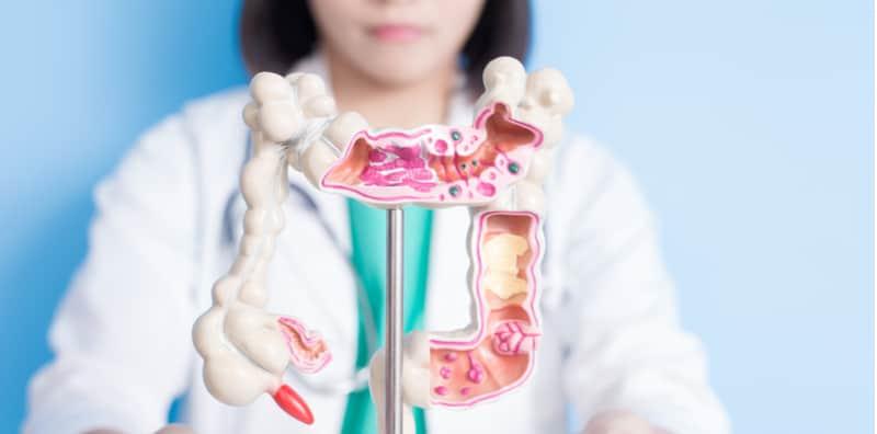 Kanser Kolon, Pembunuh Senyap Yang Berbahaya? Awasi Penyebab Sebenar Ia Berlaku!