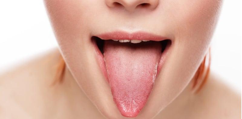 Nak Tahu Anda Sihat Atau Tidak? Periksa Warna Lidah Masing-masing!