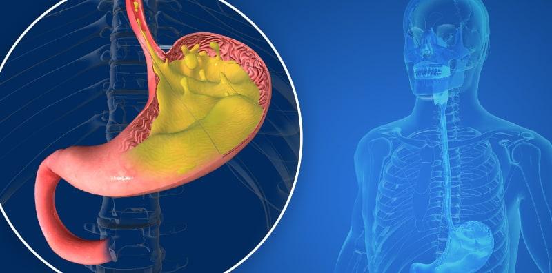 pedih-ulu-hati-bangun-tidur