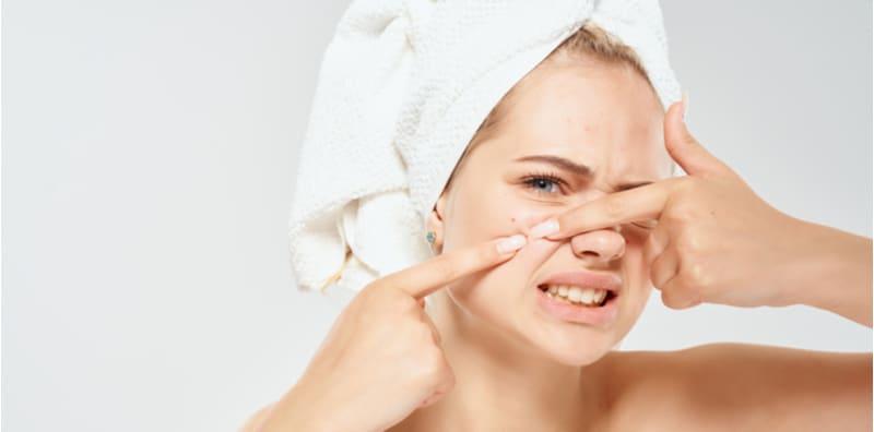 Jangan Pandai-pandai Rawat Jerawat Dengan BAKING SODA! Buruk Kesannya Nanti