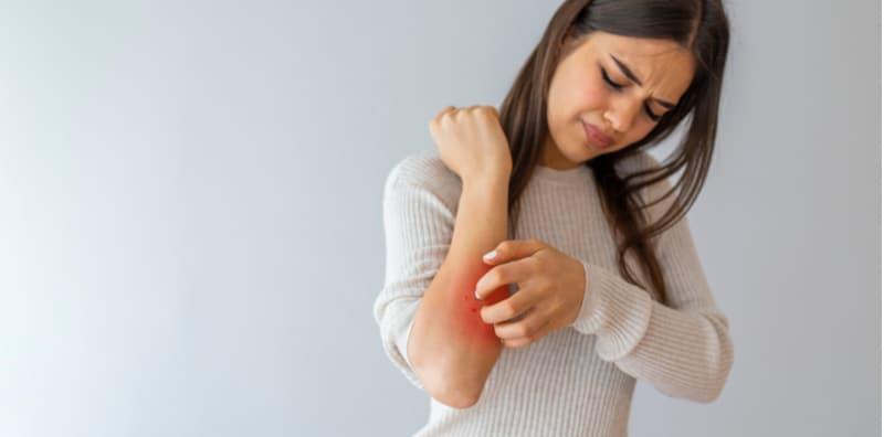 Boleh Ke Probiotik Merawat Masalah Kulit Ekzema? Ini Jawapan Menurut Kajian