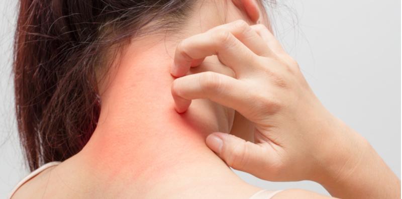 Tiada Alergi Tapi Badan Rasa Gatal-gatal, Ini Mungkin Petanda Anda Terlampau Stres!