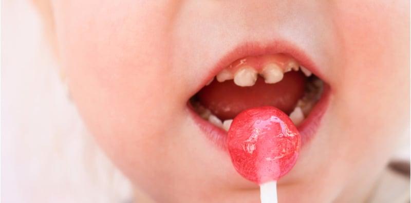 cara-elak-gigi-kanak-kanak