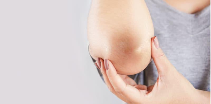 Muka Putih Tapi Siku & Lutut Hitam? Petua Semula Jadi Ini Bantu Cerahkannya Kembali