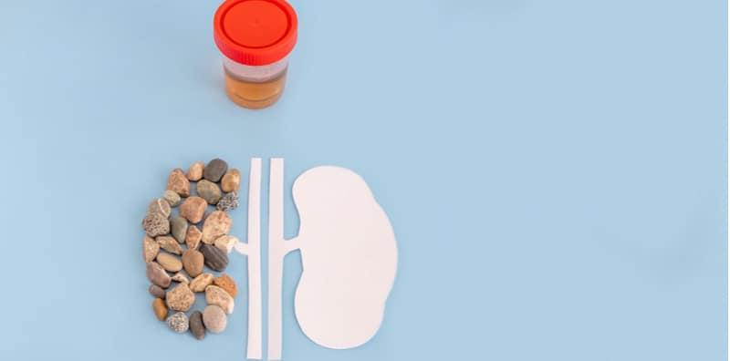 penyakit-batu-karang