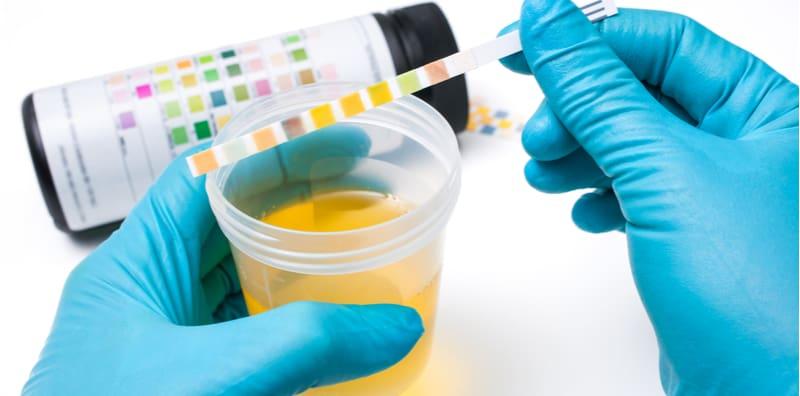 Langkah Menangani Masalah Kencing Kotor (UTI)