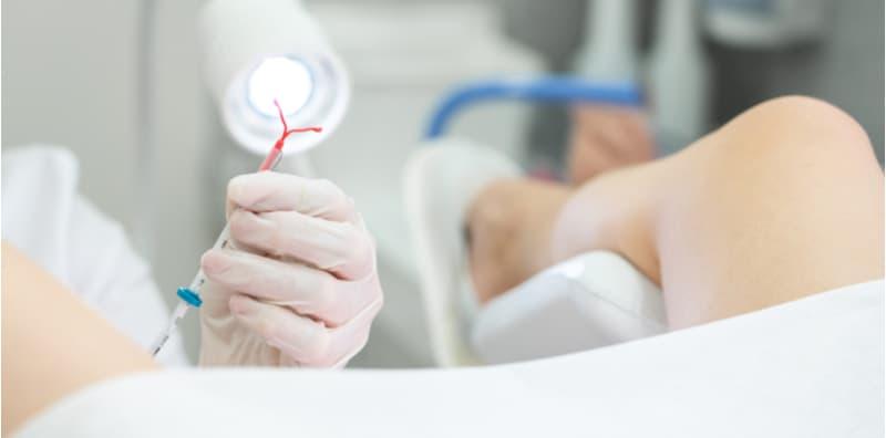 seks-kasar-iud-terkeluar