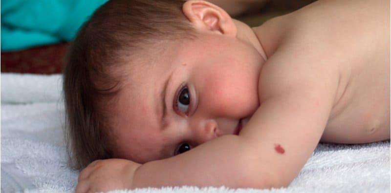 tanda-lahir-bayi-jenis