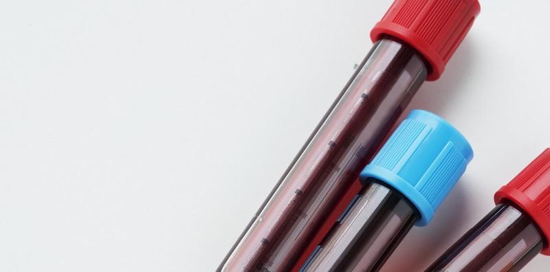 Ini Jenis Penyakit Darah Yang Anda MESTI Tahu Selain Anemia Dan Talasemia!