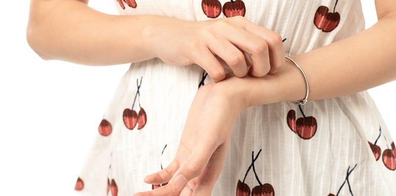 gatal-tapak-tangan-masak